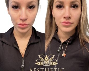 Aesthetic Beauty Lounge