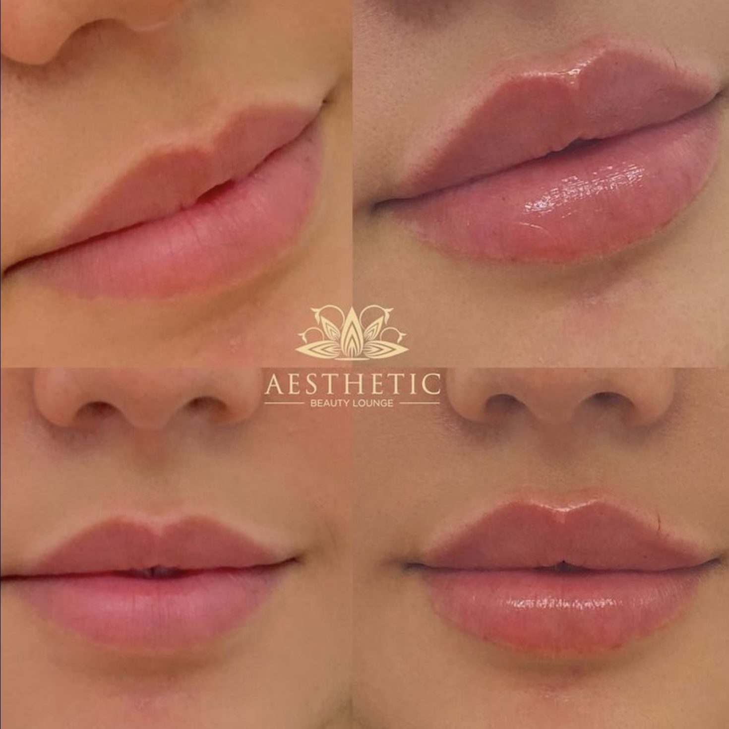 Kyssable Lips