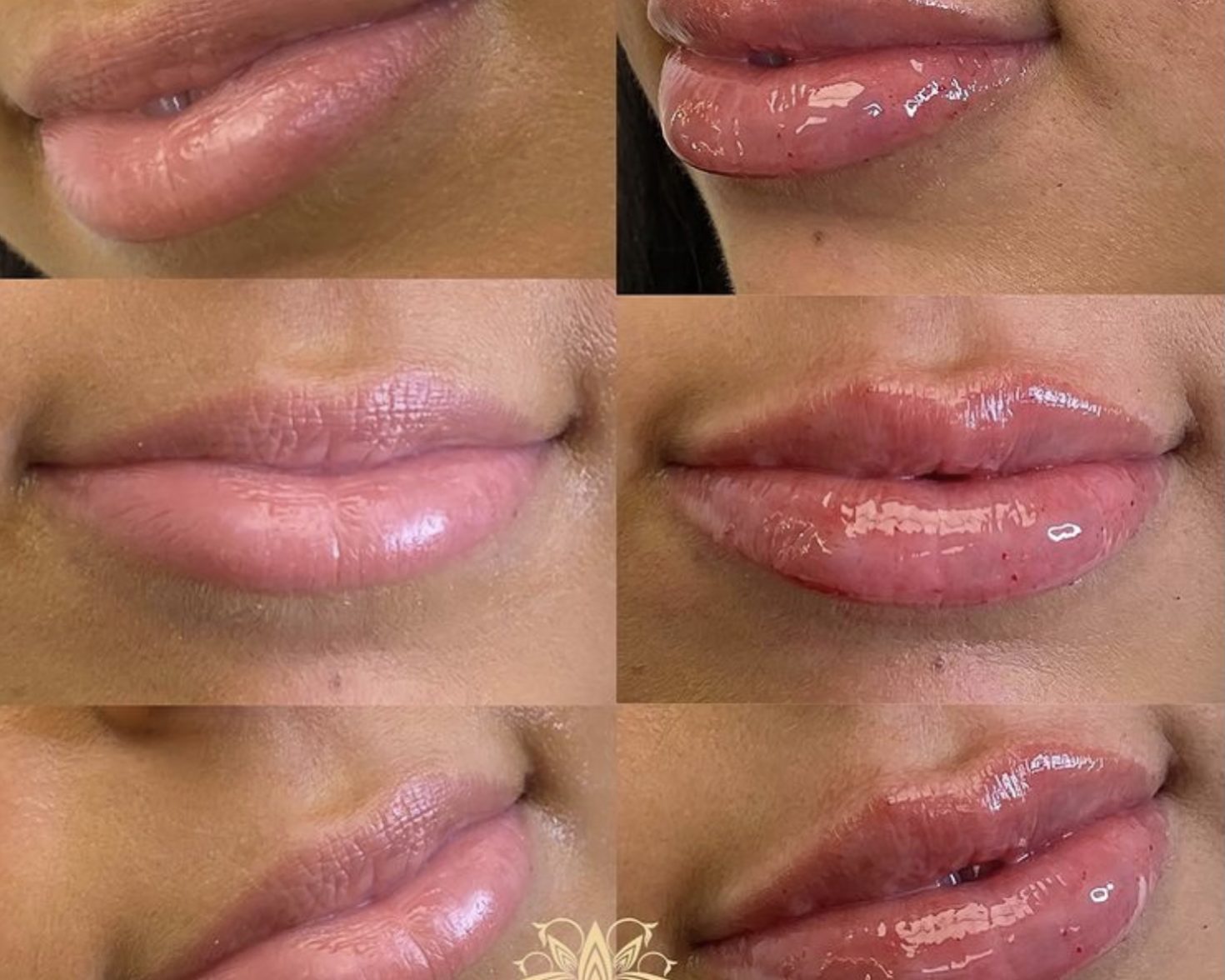 Kyssable Lips