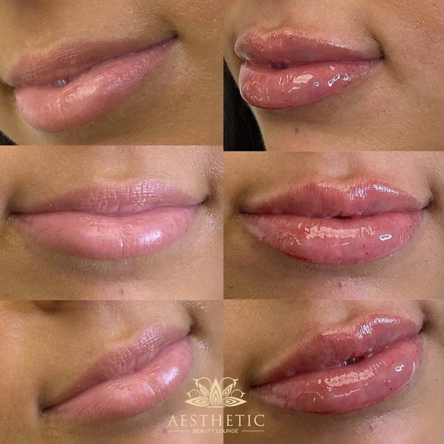 Kyssable Lips