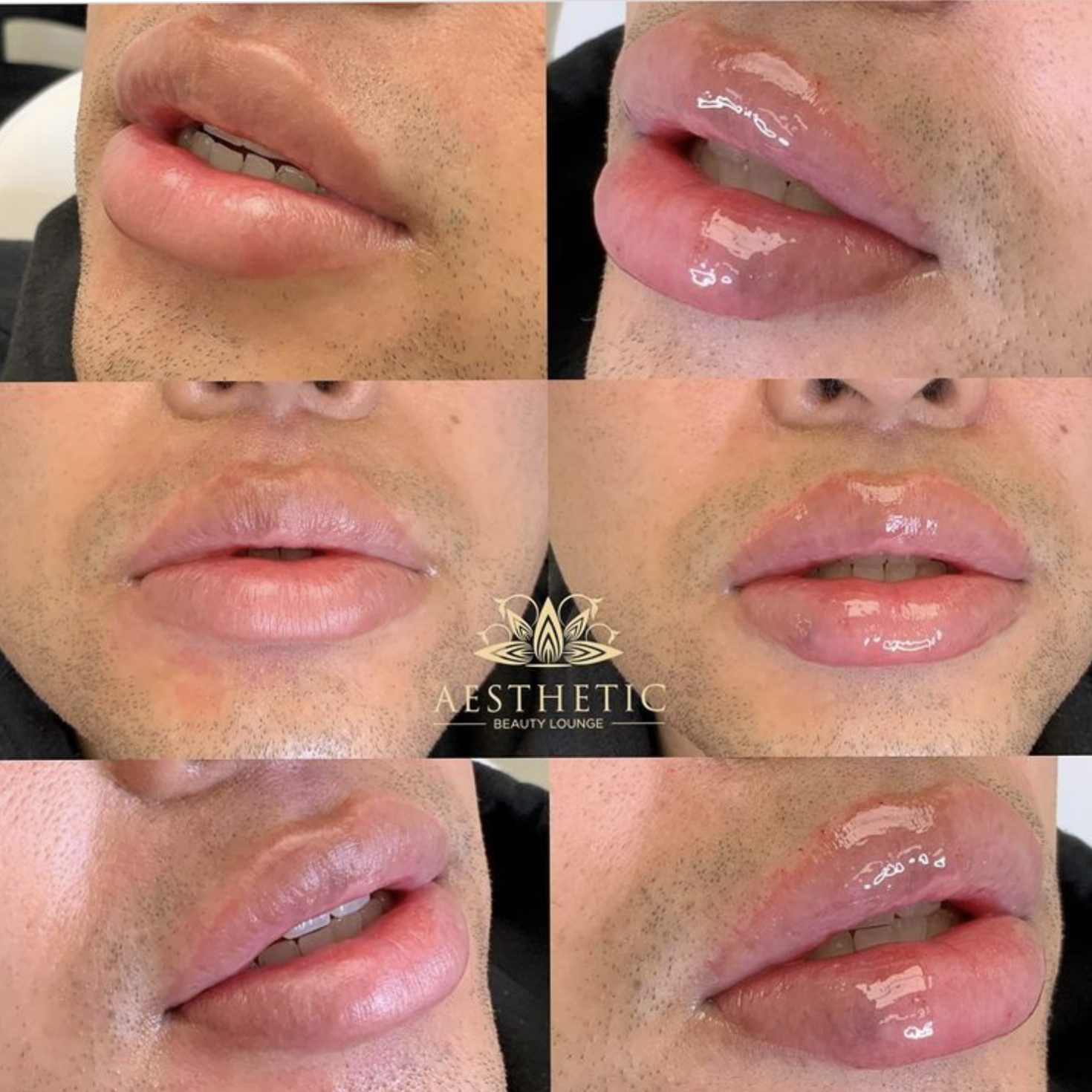 Kyssable Lips