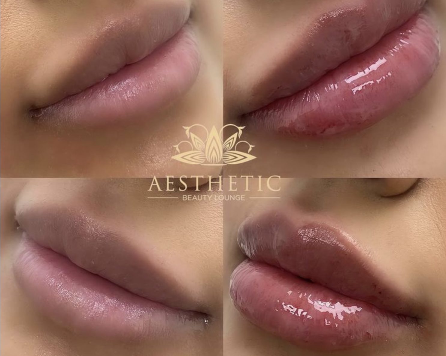 Kyssable Lips