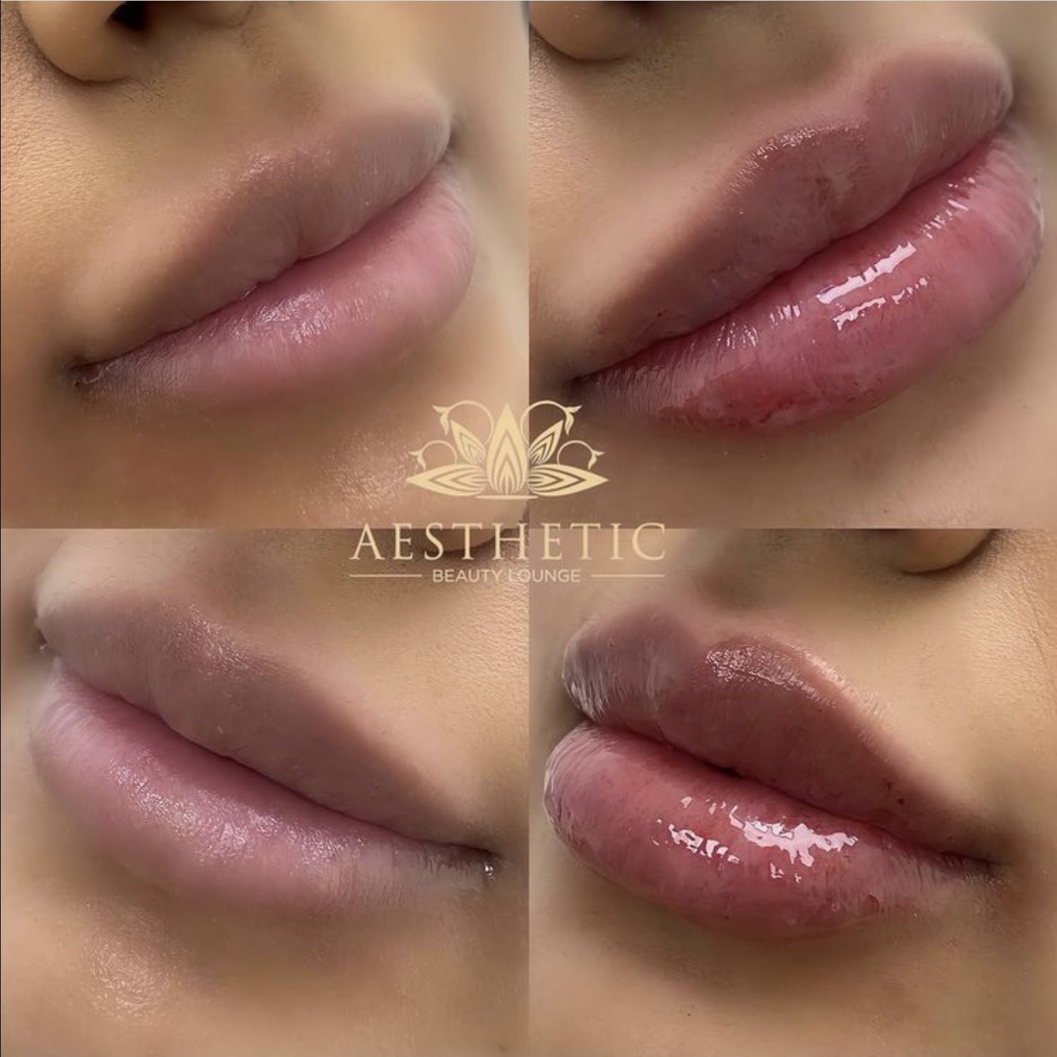 Kyssable Lips