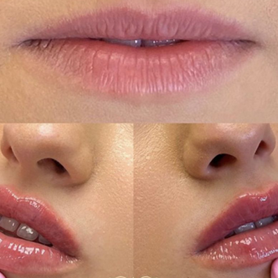 Kyssable Lips_ Aesthetic beauty lounge