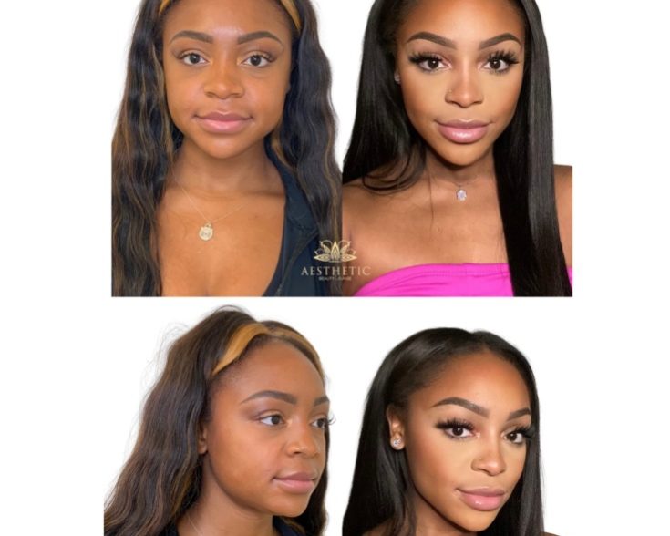 Heartbreaker Before and after