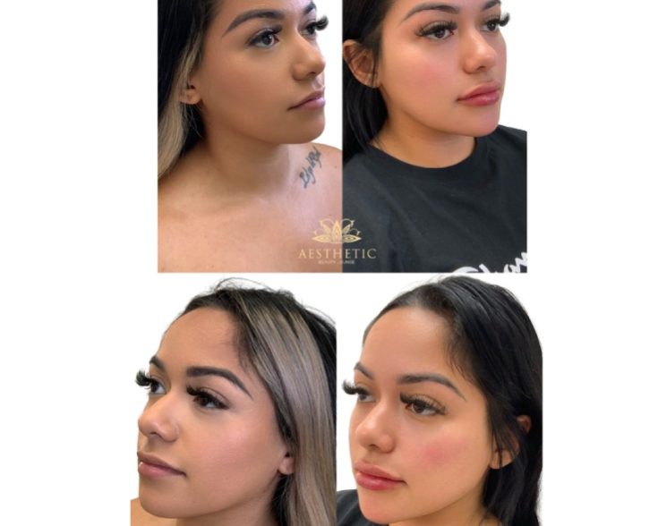 Aesthetic beauty lounge_ snatched packages