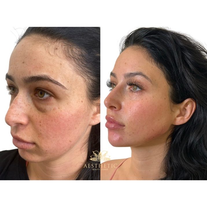 Aesthetic beauty lounge_ snatched packages