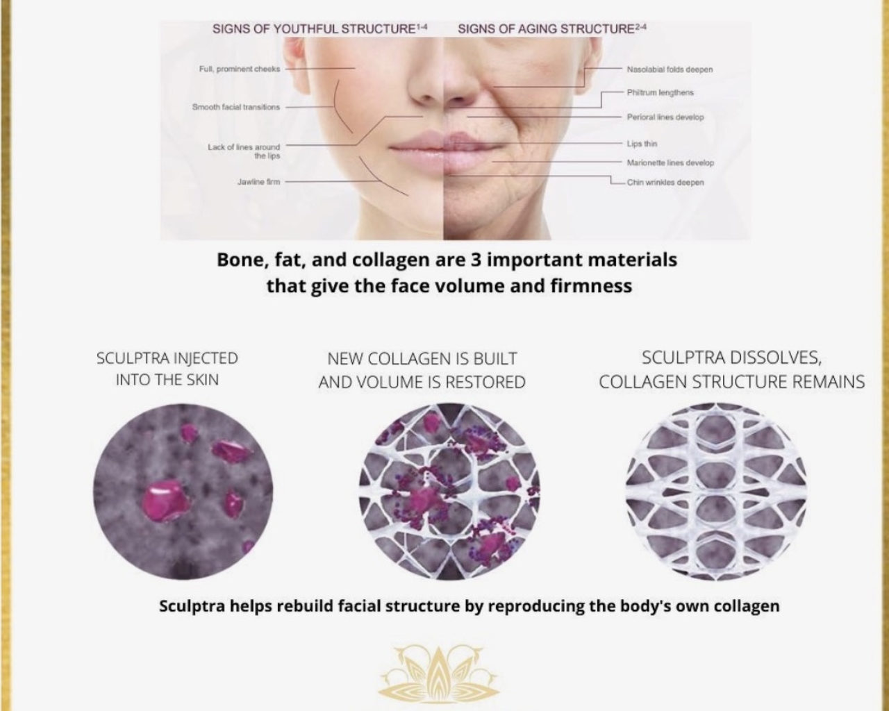 Sculptra packages
