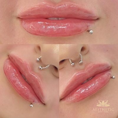 Lips Lips _ Aesthetic Beauty lounge