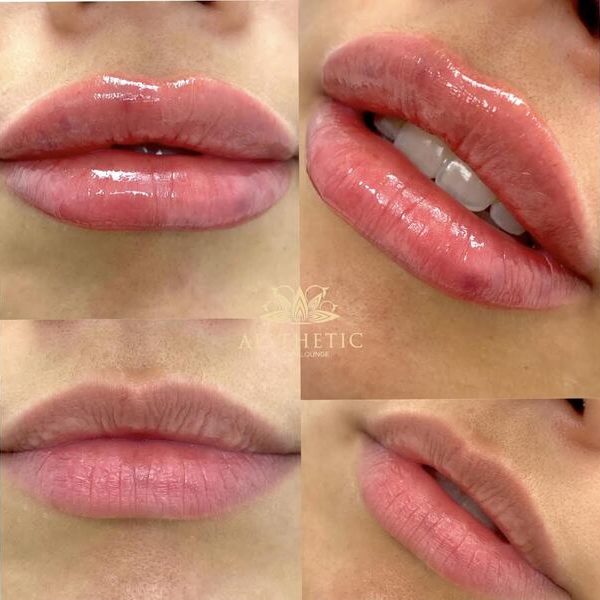 Lips Lips _ Aesthetic Beauty lounge