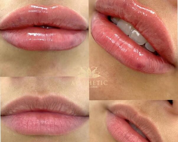Lips Lips _ Aesthetic Beauty lounge