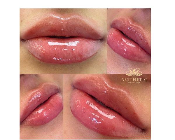 Lips Lips _ Aesthetic Beauty lounge