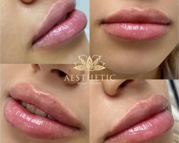 Lips Lips _ Aesthetic Beauty lounge