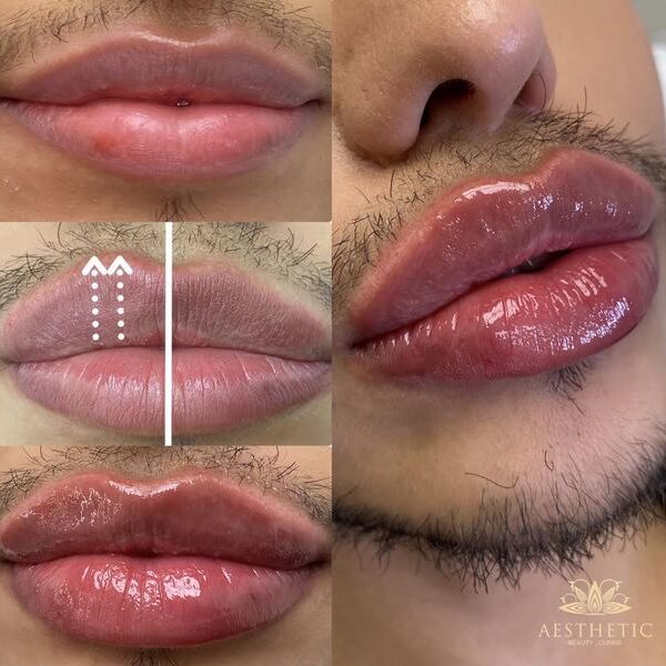 Lips Lips _ Aesthetic Beauty lounge