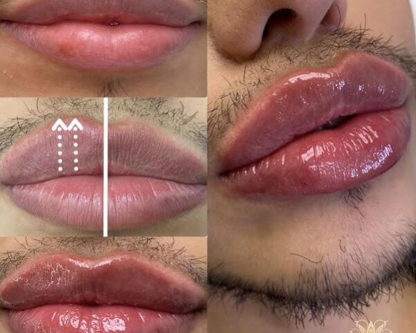 Lips Lips _ Aesthetic Beauty lounge