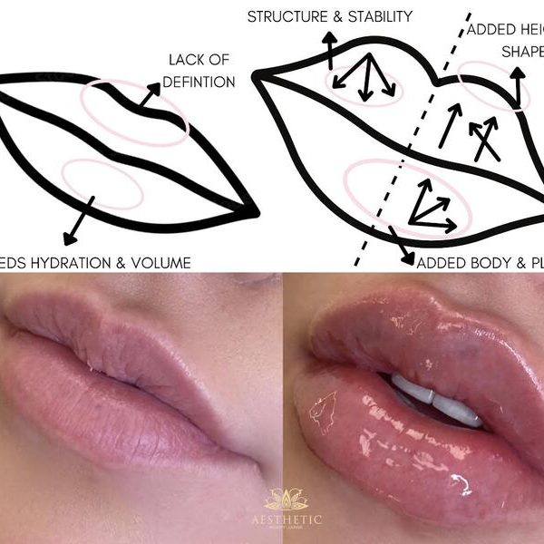 Lips Lips _ Aesthetic Beauty lounge