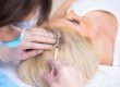 What Are The Benefits And Side Effects Of Hair Botox Treatment?